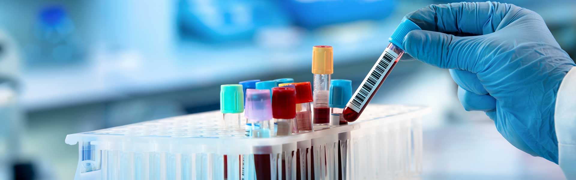 Test tube rack