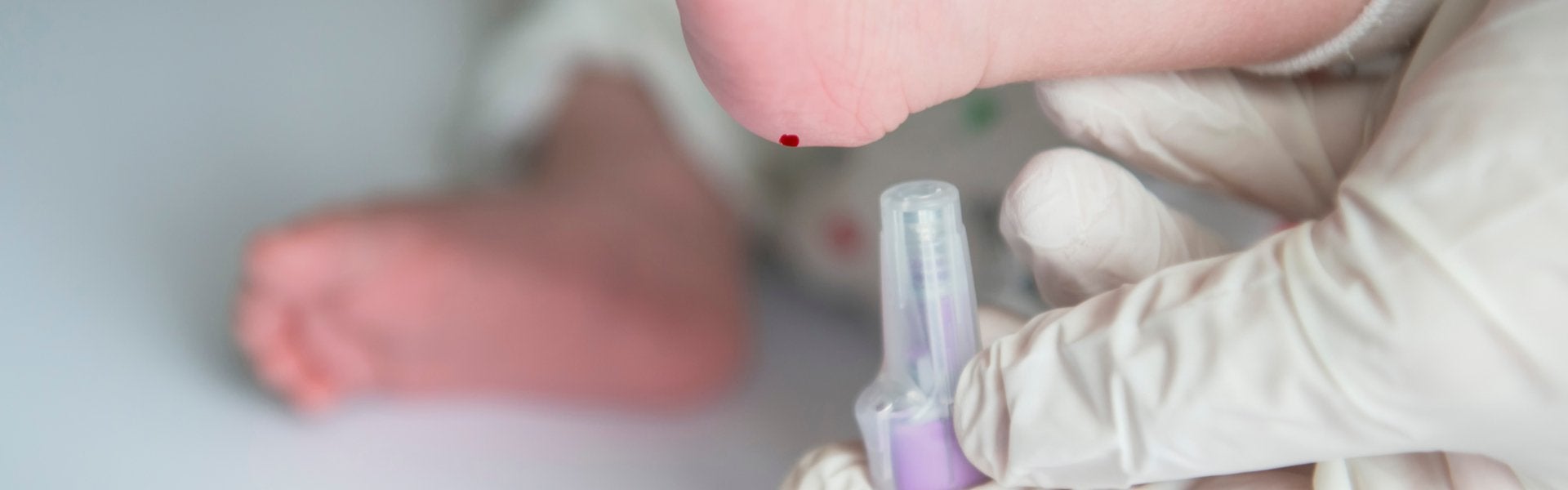 Heel prick test on a baby