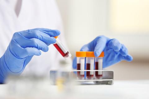 blood samples